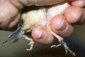 Sekund&auml;re Gangr&auml;n (Nekrose)